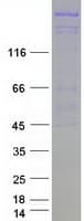 Human TDRD6 Protein (Recombinant Myc-DDK (Flag))