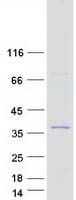 Human ALKBH6 Protein (Recombinant Myc-DDK (Flag))