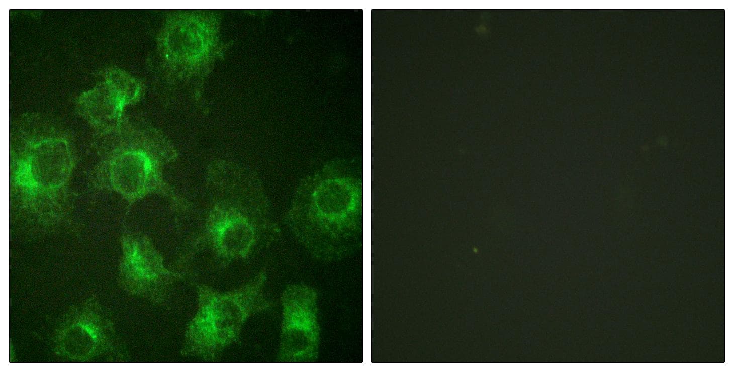 Polyclonal Rabbit anti-Human TPH1 / Tryptophan Hydroxylase Antibody (p260, IHC, IF, WB)