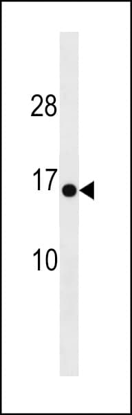 Polyclonal Rabbit anti-Human HIGD1C Antibody (aa69-97, WB)