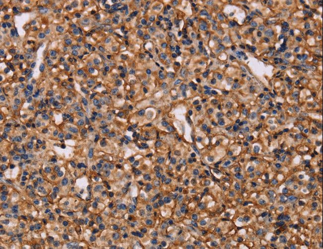 MAP1LC3C / LC3C Antibody