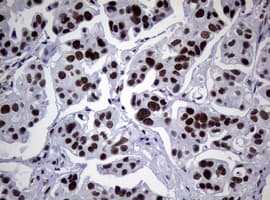 NBN / Nibrin Antibody (clone OTI7D5)