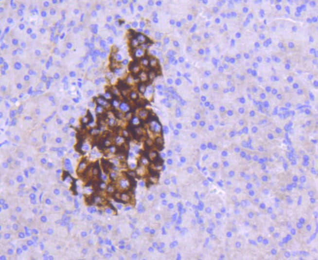 MCL1 / MCL 1 Antibody
