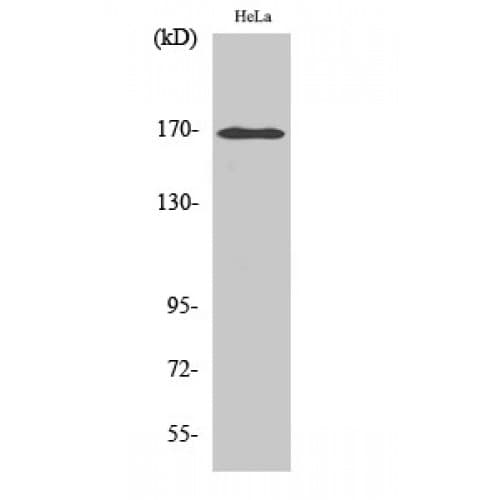 Polyclonal Rabbit anti-Human ABCC3 / MRP3 Antibody (940-1020 aa, Internal, WB)