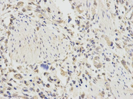 TNFAIP3 / A20 Antibody