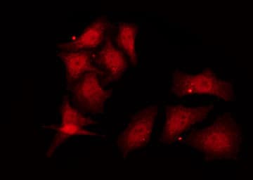 TSG101 Antibody