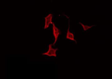 ITGB1 / Integrin Beta 1 / CD29 Antibody