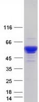 Human SERPINA1 / Alpha 1 Antitrypsin Protein (Recombinant Myc-DDK (Flag))
