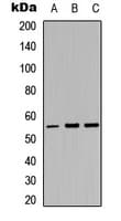 Polyclonal Rabbit anti-Human PKMYT1 Antibody (Internal, IHC, WB)