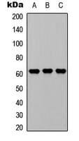 Polyclonal Rabbit anti-Human GGT1 / GGT Antibody (Internal, WB)