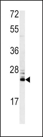 Polyclonal Rabbit anti-Human MSRA Antibody (aa34-63, IHC, IF, WB)