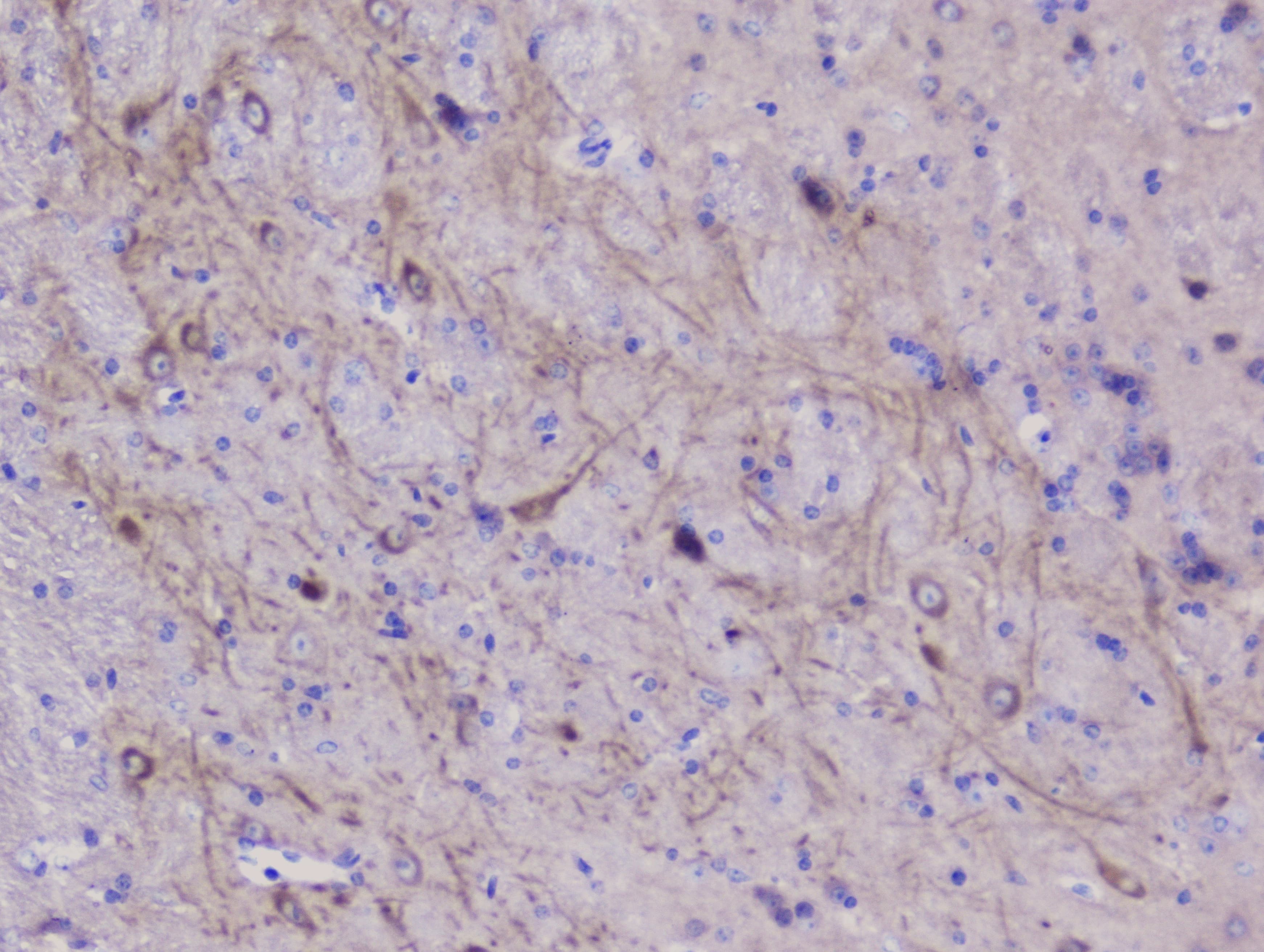 ENO2 / NSE Antibody
