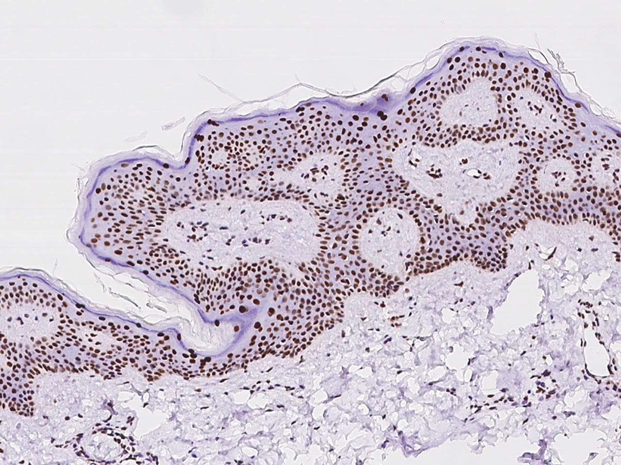 PCYT1A / CCT Alpha Antibody
