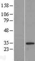 C22orf31 Protein (Over-Expression Lysate Myc-DDK (Flag))