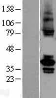 TSSK2 Protein (Over-Expression Lysate Myc-DDK (Flag))