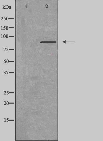 Polyclonal Rabbit anti-Human CDH3 / P-Cadherin Antibody (IHC, IF, WB)