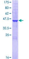 Human ST6GAL1 / CD75 Protein (Recombinant GST)