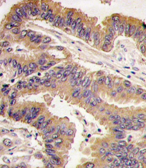 Polyclonal Rabbit anti-Human GDF5 / GDF-5 Antibody (aa13-41, IHC, WB)