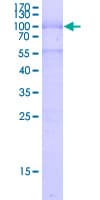 Human SOX11 Protein (Recombinant GST)