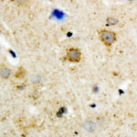 Polyclonal Rabbit anti-Human ADRBK2 / GRK3 Antibody (Internal, IHC, WB)