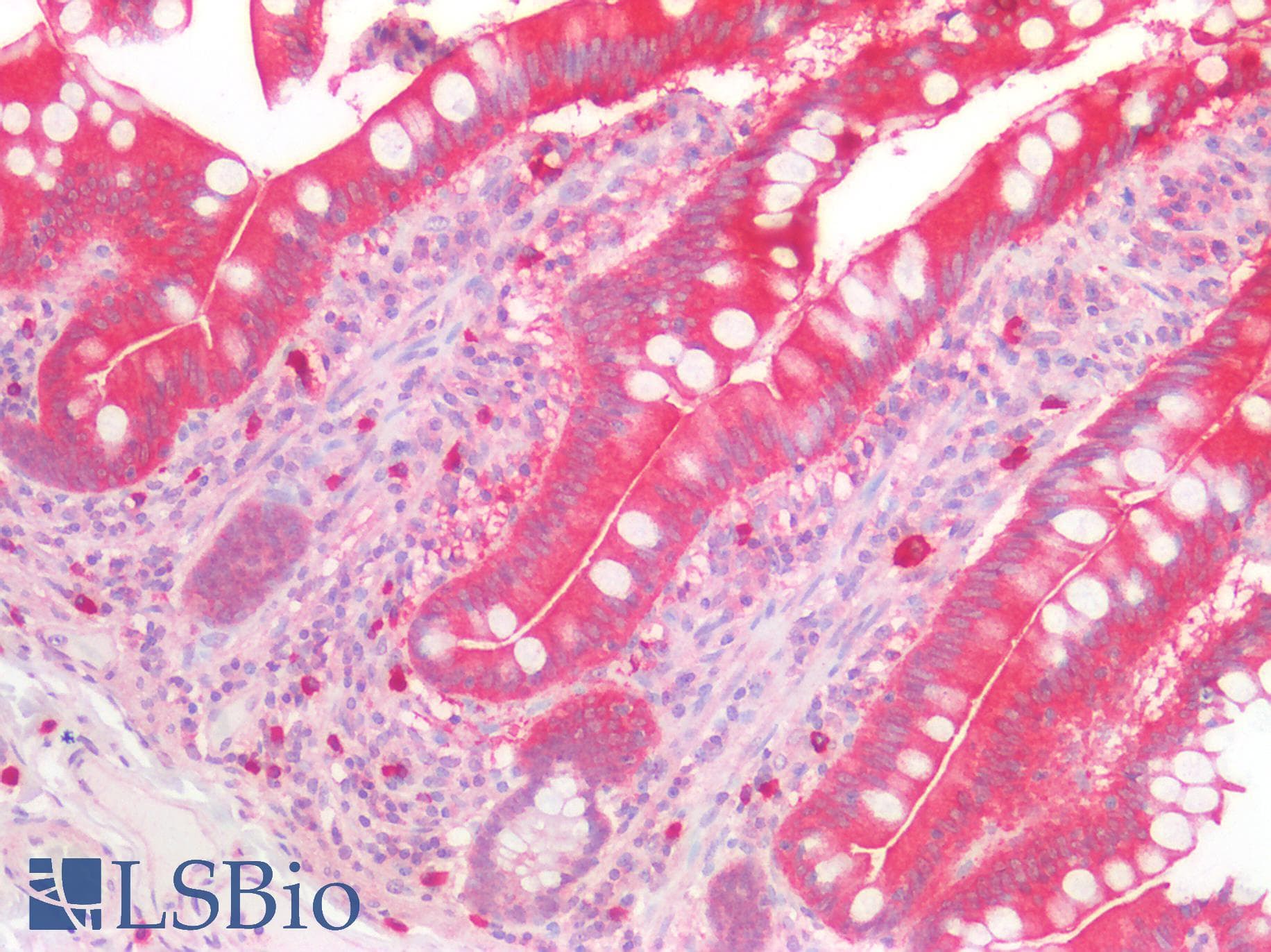 IHC-plus™ VIL1 / Villin Antibody (aa7-246)
