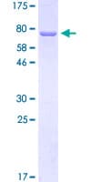 Human KRT12 / CK12 / Cytokeratin 12 Protein (Recombinant GST)