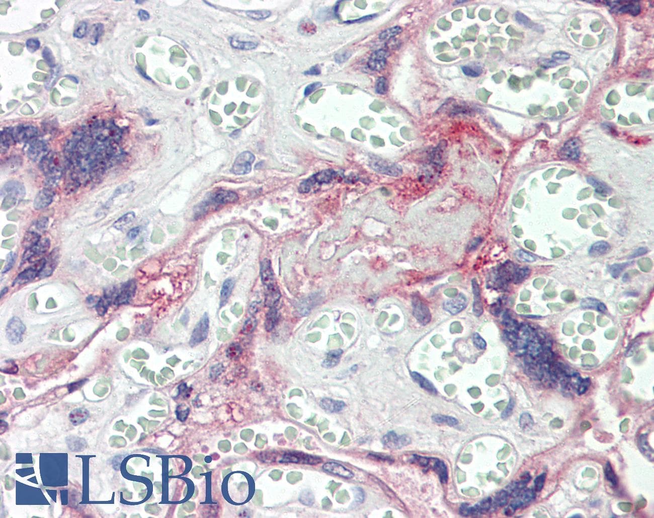 IHC-plus™ TLK1 Antibody (aa730-779)