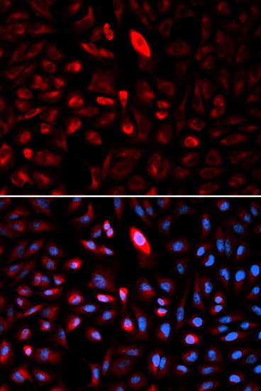 IHC-plus™ TCP1 Antibody