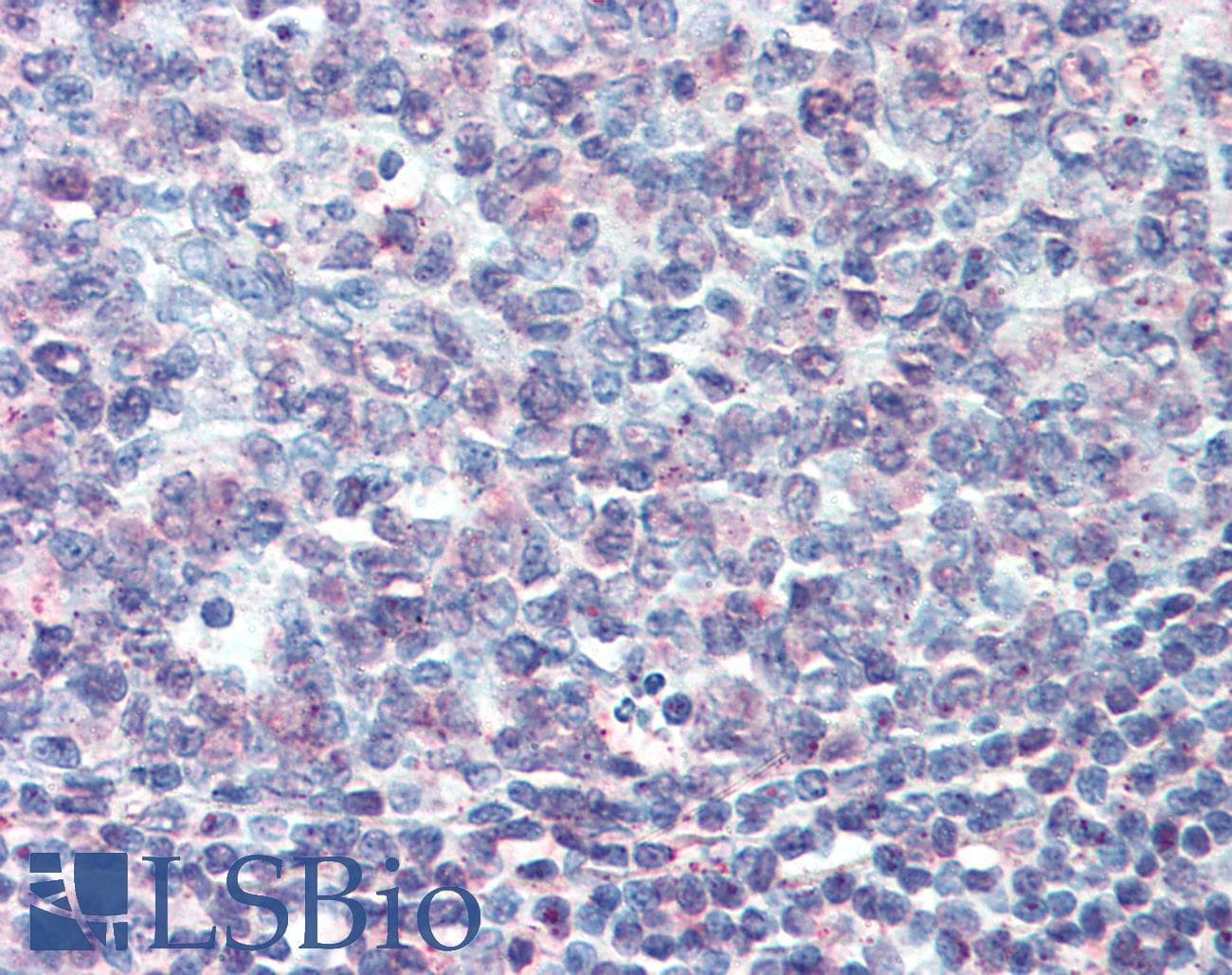 IHC-plus™ CD27L / CD70 Antibody (N-Terminus)