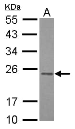 RAB3B Antibody