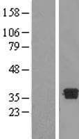 DHRS7B Protein (Over-Expression Lysate Myc-DDK (Flag))