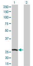 PSPH Antibody (clone 3A5)