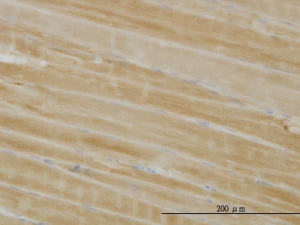 PHKG1 Antibody (clone 2B4)