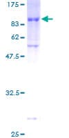 Human ZNF165 Protein (Recombinant GST)