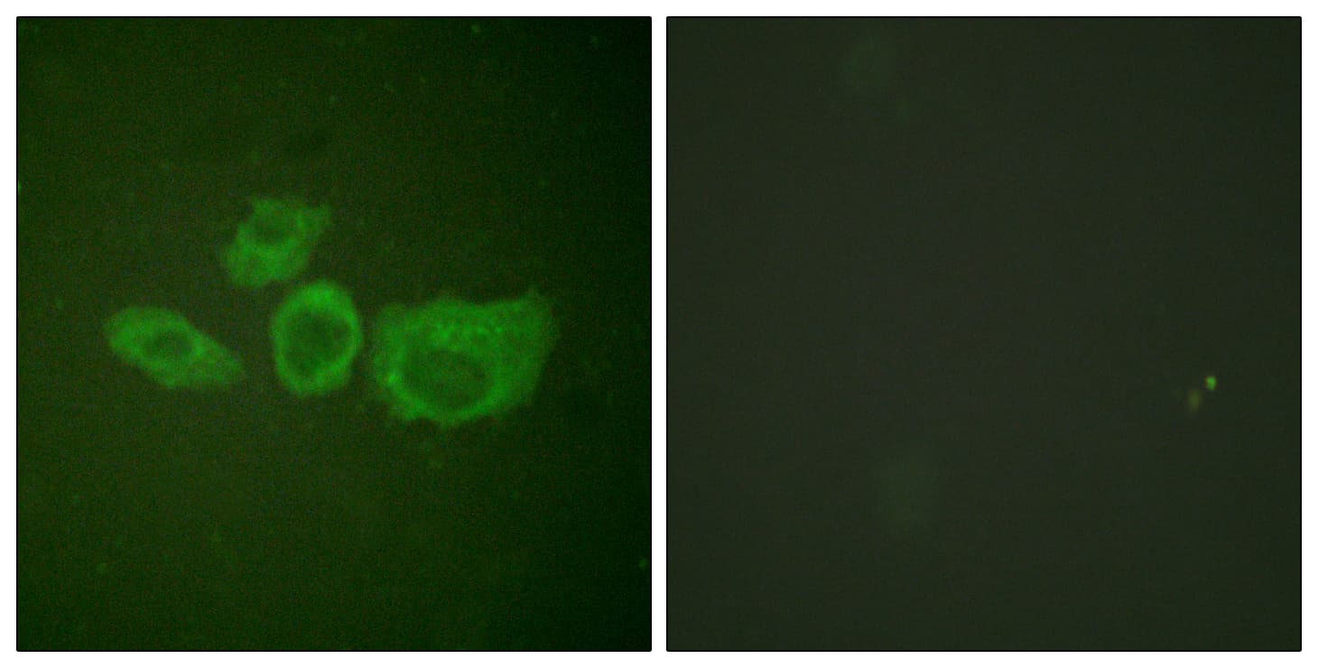 IHC-plus™ Polyclonal Rabbit anti-Human TH / Tyrosine Hydroxylase Antibody (aa41-90, IHC, IF, WB)