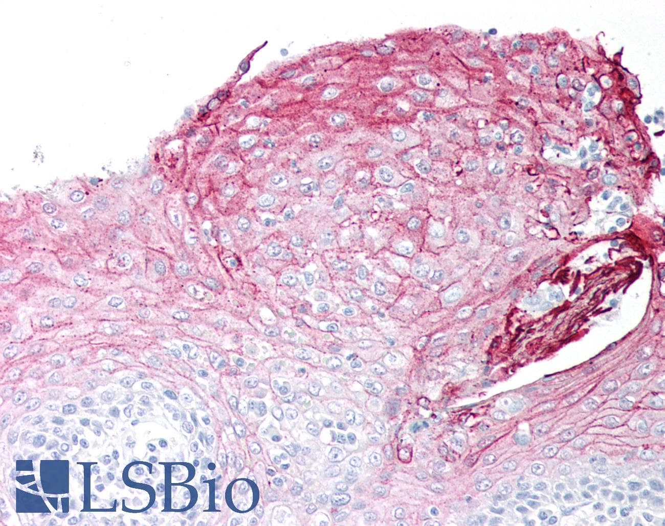 PathPlus™ ANXA1 / Annexin A1 Antibody