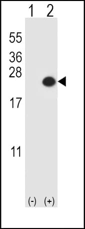 Polyclonal Rabbit anti-Human DUSP3 / VHR Antibody (aa1-30, IHC, WB)