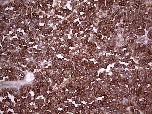 PKM2 Antibody (clone 12B9)