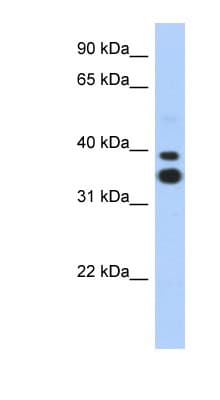 Polyclonal Rabbit anti-Human MSX2 / MSH Antibody (N-Terminus, WB)