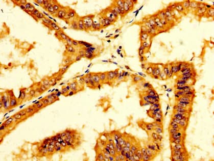 Polyclonal Rabbit anti-Human PPA1 Antibody (IHC)