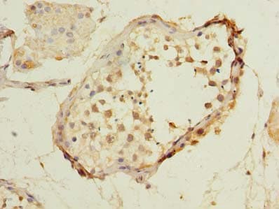 Polyclonal Rabbit anti-Human MXD3 / MAD3 Antibody (IHC)