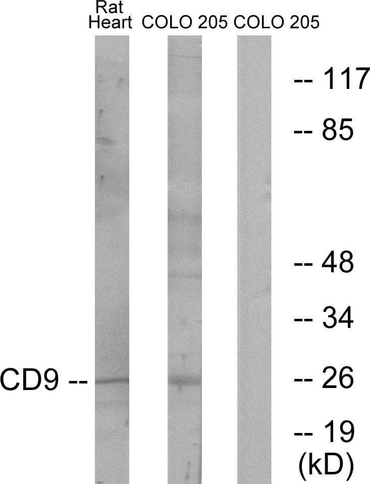 Polyclonal Rabbit anti-Human CD9 Antibody (IHC, IF, WB)