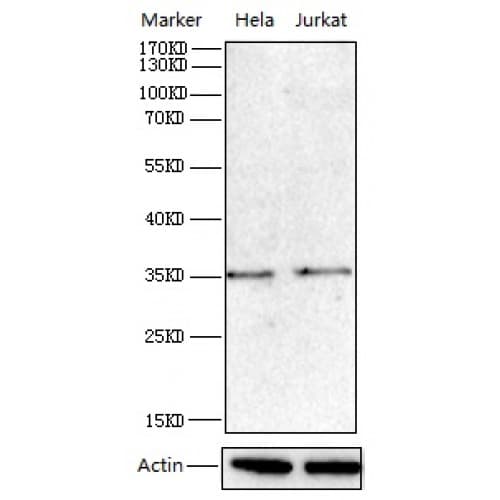 Polyclonal Rabbit anti-Human PCNA Antibody (30-110 aa, Internal, IHC, WB)