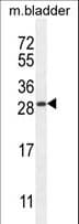 Polyclonal Rabbit anti-Human TIFAB Antibody (aa37-66, WB)