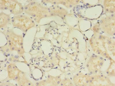 PIGO Antibody