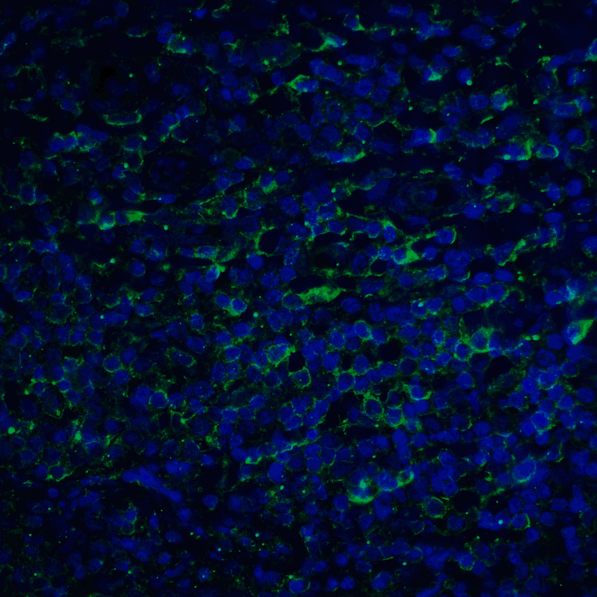 IHC-plus™ Monoclonal Mouse anti-Human PD-L2 / PDCD1LG2 / CD273 Antibody (clone 7C7, IHC, IF, WB)