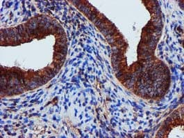 EPN2 Antibody (clone OTI1C5, Carrier-free)