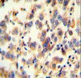 UGT3A2 Antibody (aa377-405)