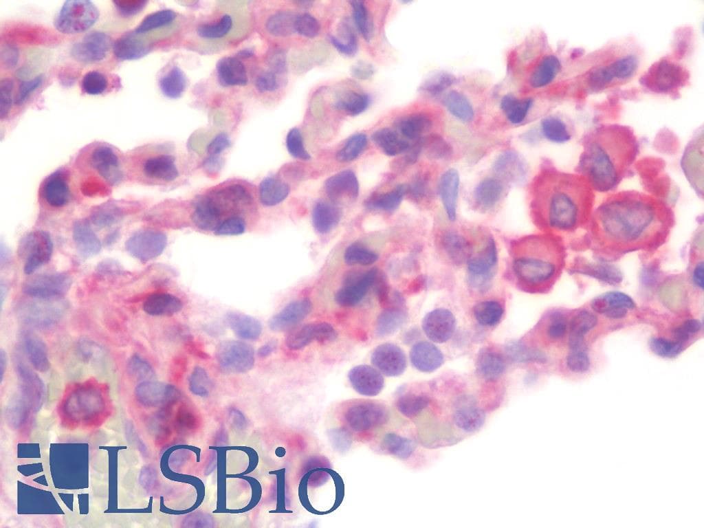 IHC-plus™ MRPL20 Antibody (aa100-149)