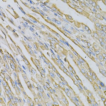 CDA / Cytidine Deaminase Antibody